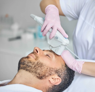FOTOFACIAL IPL