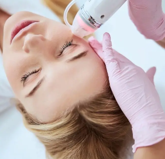 MICROAGUJAS CON RADIOFRECUENCIA