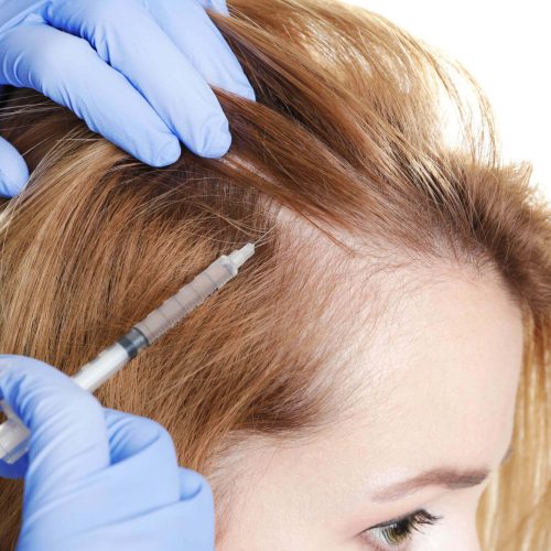 Top-8-Hair-Regrowth-Treatments
